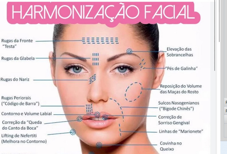 HARMONIZAÇÃO FACIAL
